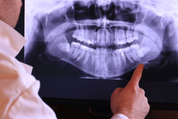 Best Emergency Dental Extractions in Lusk, WY
